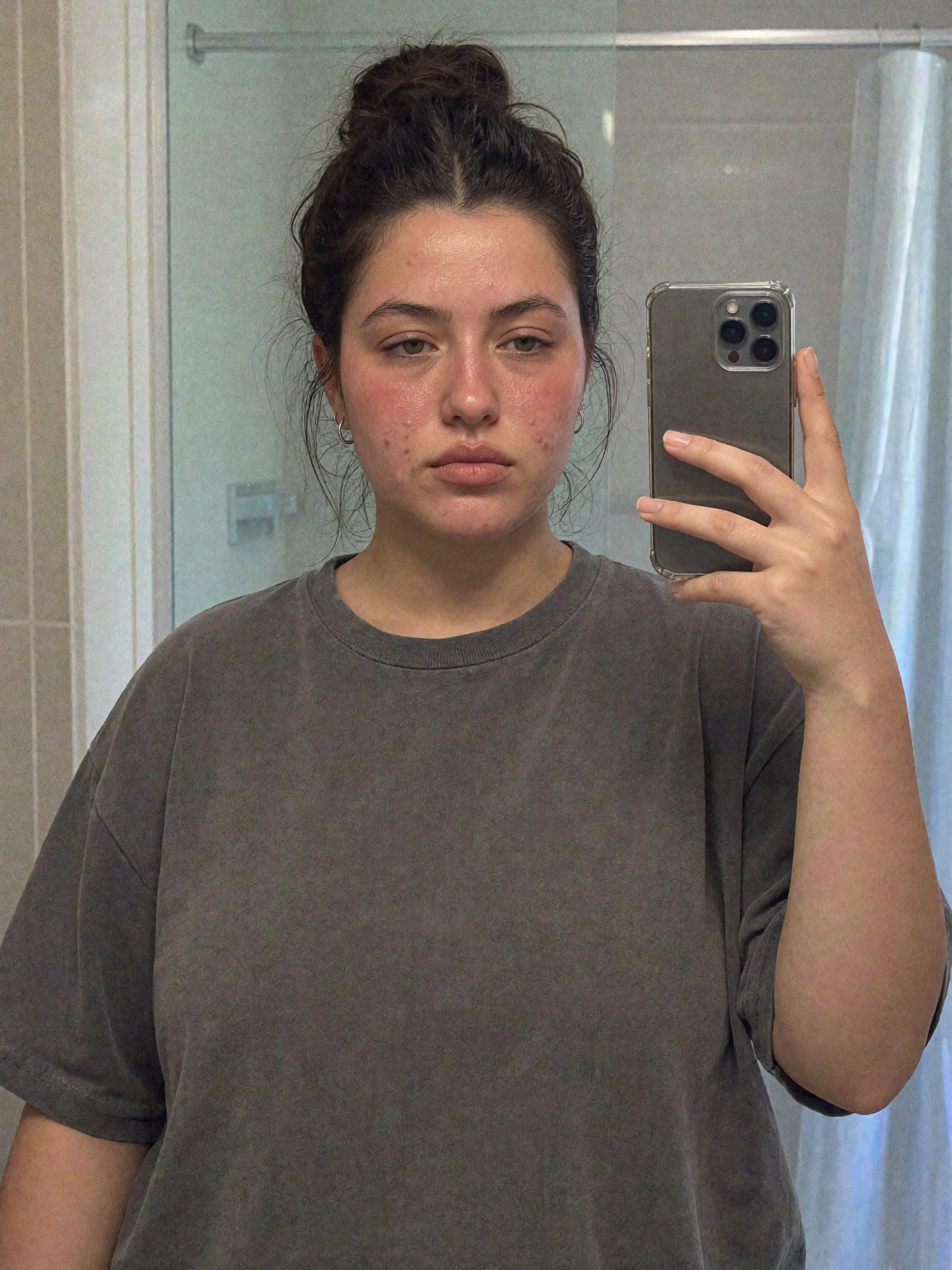Before — transformation 2